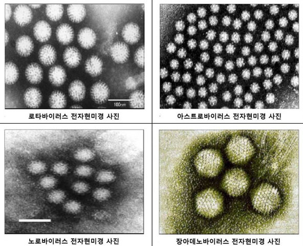 바이러스성 병원체 현미경 사진. (출처: 수인성식품매개질환 실험실 진단지침)