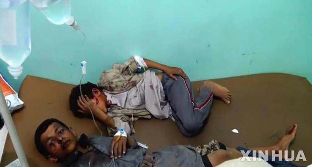 9일(현지시간) 사우디 아라비아 주도 연합군의 공습으로 부상당한 예멘 어린이들이 병원에 누워 있다. 이날 공습으로 현장 학습을 위해 이동하던 통학버스가 폭격 당해 최소 50명이 사망하고, 77명이 부상당한 것으로 전해진다. (출처: 뉴시스)