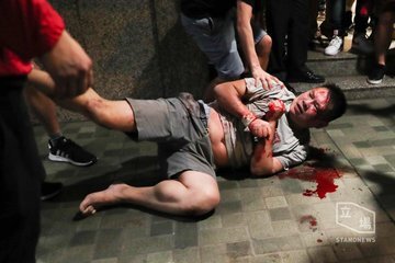 홍콩 민주주의 시위 현장 칼 공격 4명 부상, 홍콩 구의원 귀 뜯겨(출처: BBC캡처)