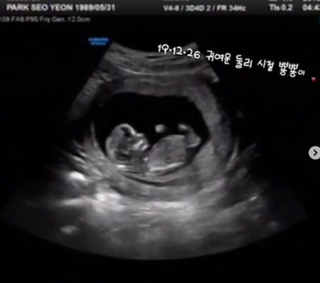 김경록 아내 임신 (출처: 김경록 인스타그램)