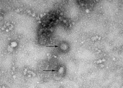 신종 코로나바이러스 전자현미경 사진. (제공: 질병관리본부)