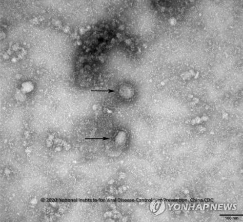 신종 코로나바이러스(코로나19) 전자현미경 사진 (출처: 연합뉴스)