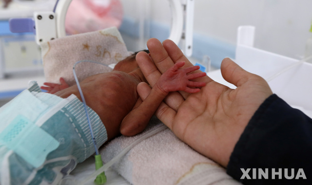작년 12월 예멘 수도 사나의 알사빈 병원 영양실조 예방 병동에서 한 엄마가 영양실조로 치료받는 아이의 손을 잡고 있다. (출처: 뉴시스)