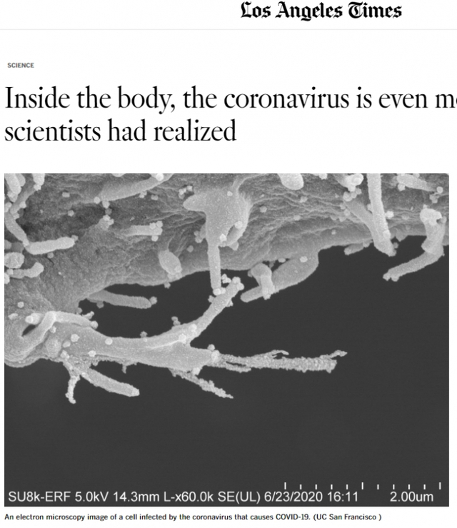 코로나바이러스 세포 이미지. (출처: 로스앤젤레스타임스 홈페이지 캡처)