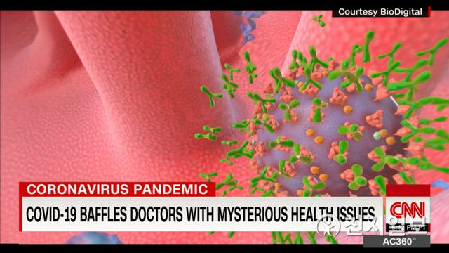 신종 코로나바이러스 감염증(코로나19)이 폐뿐만 아니라 신장, 간, 뇌 및 신경계, 피부, 위장관 등에 손상을 입힌다는 연구자료가 나왔다고 11일(현지시간) CNN방송이 보도했다. (출처: CNN 방송 캡처) ⓒ천지일보 2020.7.11