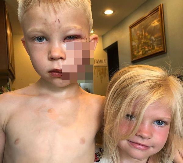 동생에게 덮친 맹견을 온몸으로 막아내 동생을 구한 6살짜리 꼬마가 미국 사회에 화제가 되고 있다.(출처: 'nicolenoelwalker' 인스타그램)