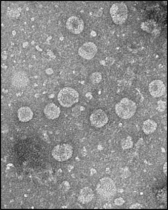 전자현미경으로 촬영한 녹차유산균 엑소솜. (제공: 아모레퍼시픽)