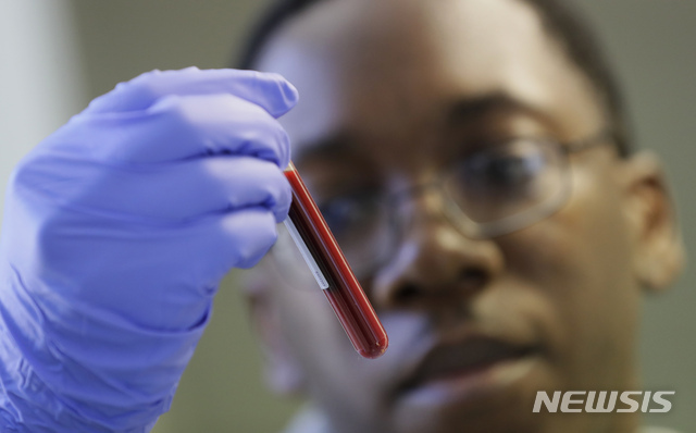 지난달 30일 리언 맥팔레인의 연구진이 런던 임페리얼 칼리지 실험실에서 지원자의 혈액 샘플을 보고 있다. (출처: 뉴시스)
