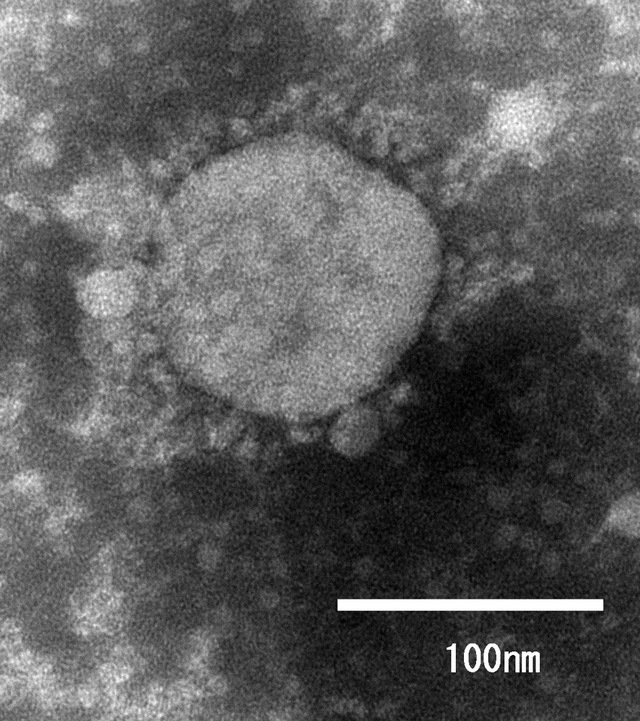 일본 국립감염증연구소가 분리하는 데 성공한 영국발 신종 코로나바이러스 감염증(코로나19) 변이 바이러스. (사진출처: 일본 국립감염증연구소 홈페이지 캡쳐)