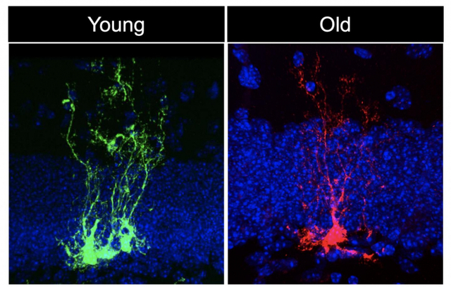 어린 생쥐(녹색)와 늙은 생쥐(적색)의 신경줄기세포. (출처: https://www.eurekalert.org, Albina Ibrayeva/Bonaguidi Lab 제공)