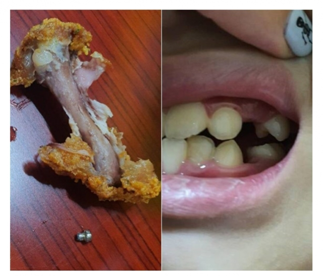 프랜차이즈 업체 치킨에서 나온 나사. 제보자 제공. (출처: 연합뉴스) ⓒ천지일보 2021.11.3