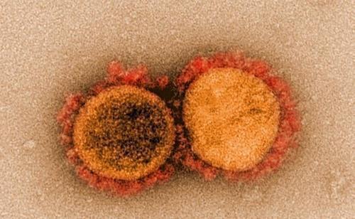 신종 코로나바이러스의 전송 전자현미경 이미지. 미국 NIAID(국립 알레르기 감염병 연구소) 제공. (출처: 연합뉴스)