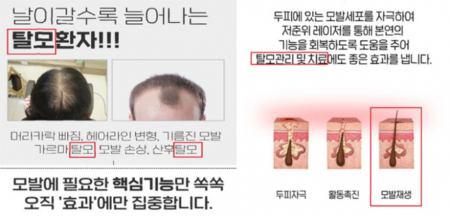 의료기기 오인 광고 예시. (제공: 식품의약품안전처)